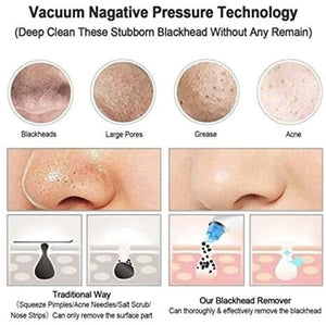 🖤 ​​جهاز شفط لإزالة الرؤوس السوداء – منظف عميق للمسام لبشرة صافية