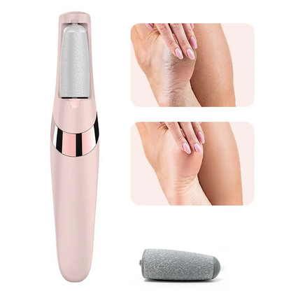 Electric Callus Remover - Rechargeable Foot File for Smooth Heels